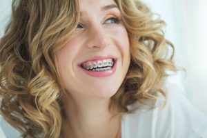 Myths about orthodontic treatment 