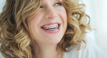Myths about orthodontic treatment