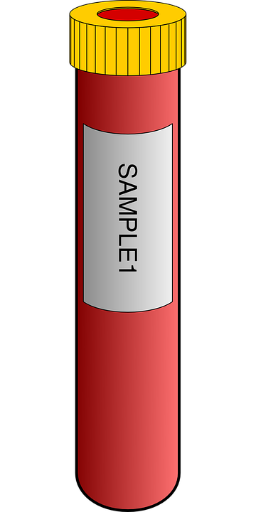 All You Need To Know About Blood Collection Tubes You Must Get Healthy All You Need To Know About Blood Collection Tubes You Must Get Healthy