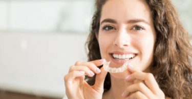 5 Things To Know About Invisalign