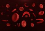 What is Sickle Cell Anemia?