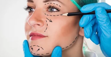 How to Speed Up Facelift Surgery Recovery