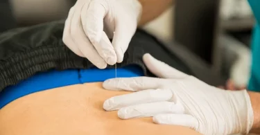 Sports Injuries: Speed up the Healing With Acupuncture