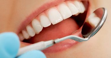 Things To Consider Before Consulting A Cosmetic Dentist