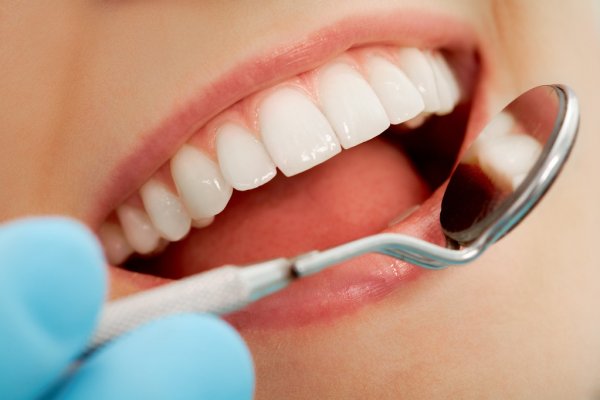 Things To Consider Before Consulting A Cosmetic Dentist