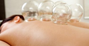 Benefits Of Cupping Therapy?