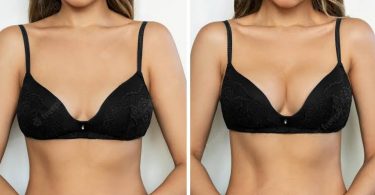 Does Breast Actives really work?